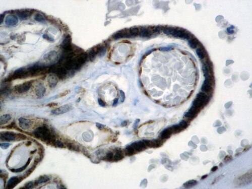 IHC of VEGF on an FFPE Kidney Tissue